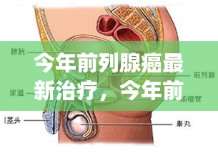 今年前列腺癌最新治疗进展概览，探索最新治疗方法和进展