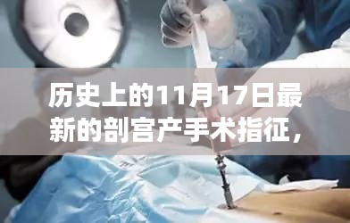 11月17日新剖宫产手术指征，开启剖宫产新纪元温馨手术室之旅